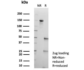 SDS-PAGE analysis of purified, BSA-free AKR1C1 antibody (clone AKR1C1/9311) as confirmation of integrity and purity.