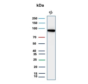 Western blot analysis of CDH17 antibody in human small intestine tissue lysate. The recombinant mouse mAb clone rCDH17/9677 detects a prominent band above 92 kDa, consistent with Cadherin 17. The predicted molecular weight of Cadherin 17 is approximately 92 kDa based on its amino acid sequence; however, the protein is heavily glycosylated, which commonly results in slower migration and an apparent higher molecular weight on SDS-PAGE. The observed band pattern aligns with expected glycosylated CDH17 expression in small intestinal epithelial tissue.