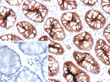 Immunohistochemistry of CDH17 antibody in human colon tissue. The recombinant mouse mAb clone rCDH17/9677 demonstrates strong membranous HRP-DAB brown staining along the lateral borders of colonic epithelial cells, consistent with Cadherin 17 localization in intestinal epithelium. Staining highlights well-formed glandular crypt structures with preserved apical-basal polarity, while surrounding stromal tissue shows minimal background signal. The negative control inset, using PBS in place of the primary antibody, shows no specific staining. Heat-induced epitope retrieval was performed by boiling tissue sections in pH 9 10mM Tris with 1mM EDTA for 20 minutes followed by cooling prior to incubation.