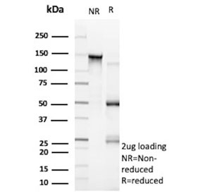 SDS-PAGE analysis of purified, BSA-free recombinant CDH17 antibody (clone rCDH17/9677) as confirmation of integrity and purity.