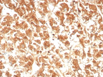IHC staining of FFPE human adrenal gland tissue with Interleukin 18 antibody (clone IL18/4623). HIER: boil tissue sections in pH 9 10mM Tris with 1mM EDTA for 20 min and allow to cool before testing.