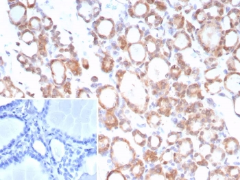 Immunohistochemistry analysis of TrkB / NTRK2 antibody (clone NTRK2/7929) in human thyroid tissue. FFPE human thyroid tissue shows membranous and cytoplasmic HRP-DAB brown staining in follicular epithelial cells, while surrounding stromal elements are largely negative. The inset shows the negative control with PBS used in place of the primary antibody, demonstrating absence of HRP-DAB brown signal. Heat-induced epitope retrieval was performed by boiling tissue sections in pH 9 10mM Tris with 1mM EDTA for 20 min followed by cooling prior to staining.