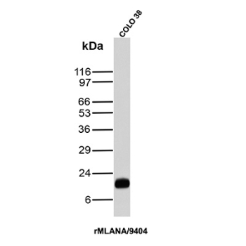 MLANA Antibody COLO-38 WB. Western blot analysis of human COLO-38 cell lysate using MLANA Antibody / Melanocyte Lineage Marker Antibody clone rMLANA/9404. A strong band is detected near approximately 20 kDa, consistent with the predicted molecular weight of Melan A / MLANA, a melanocyte lineage-associated protein involved in melanosome biology and melanoma differentiation pathways. A closely migrating doublet may represent alternatively processed or post-translationally modified MLANA-associated protein species commonly observed in melanoma-derived cell lines.