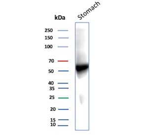 Western blot testing of human stomach tissue lysate with recombinant Carbonic Anhydrase IX antibody. Predicted molecular weight: 50-55 kDa but may be observed at higher molecular weights due to glycosylation.
