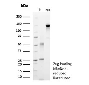 SDS-PAGE analysis of purified, BSA-free recombinant Carbonic Anhydrase 9 antibody (clone rPN-15) as confirmation of integrity and purity.