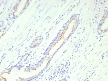 SLC45A3 Antibody for IHC. Immunohistochemistry analysis of Prostein / SLC45A3 antibody staining in FFPE human prostate tissue using clone SLC45A3/9216R. Strong cytoplasmic and perinuclear staining is observed in prostate glandular epithelial cells lining the luminal structures, consistent with Golgi-associated localization of Prostein, while surrounding stromal cells remain negative. The staining pattern highlights epithelial cell morphology and glandular architecture, supporting the role of SLC45A3 as a prostate-restricted marker in immunohistochemistry. Heat-induced epitope retrieval was performed in pH 9 Tris-EDTA buffer for 20 minutes followed by cooling prior to antibody incubation.