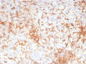 Adipose differentiation-related protein Antibody Human Adrenal Glane IHC. Immunohistochemistry staining of FFPE human adrenal gland tissue with Adipose differentiation-related protein antibody (clone rADFP/9321). HIER: boil tissue sections in pH 9 10mM Tris with 1mM EDTA for 20 min and allow to cool before testing.