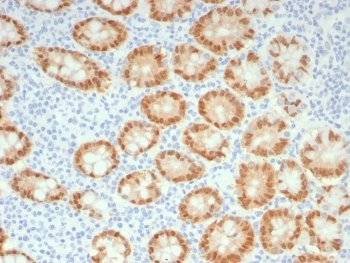 IHC staining of FFPE human colon tissue with recombinant CDX2 antibody (clone rCDX2/9241). HIER: boil tissue sections in pH 9 10mM Tris with 1mM EDTA for 20 min and allow to cool before testing.
