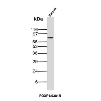 FOXP1 Antibody Ramos WB. Western blot analysis of Ramos cell lysate using FOXP1 Antibody clone FOXP1/9381R. A distinct band is detected at approximately 75-80 kDa, consistent with the expected molecular weight of Forkhead box protein P1 / FOXP1, a transcription factor involved in B-cell differentiation, lymphoid development, and transcriptional regulation. The observed signal is consistent with the established expression of FOXP1 in B-cell lineage-derived Ramos cells.