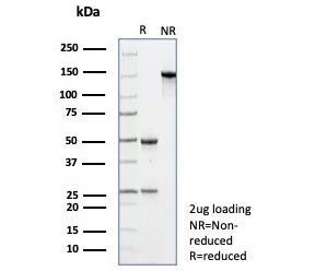 SDS-PAGE analysis of purified, BSA-free Resistin antibody (clone RETN/4325) as confirmation of integrity and purity.
