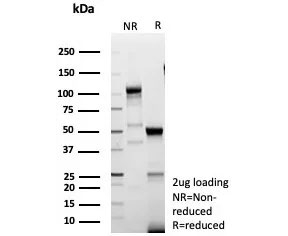 SDS-PAGE analysis of purified, BSA-free recombinant recombinant LEF1 antibody (clone LEF1/9403R) as confirmation of integrity and purity.