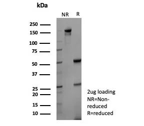SDS-PAGE analysis of purified, BSA-free KLK4 antibody (clone KLK4/8941) as confirmation of integrity and purity.