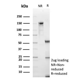 SDS-PAGE analysis of purified, BSA-free Cadherin 2 antibody (clone CDH2/9488) as confirmation of integrity and purity.
