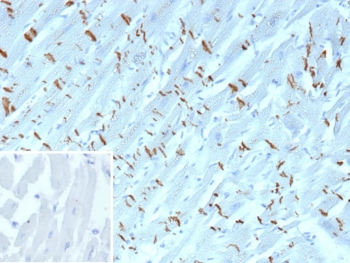 Cadherin 2 Antibody Human Heart Tissue IHC. Immunohistochemistry staining of FFPE human heart tissue with Cadherin 2 antibody (clone CDH2/9489). Inset: PBS used in place of primary Ab (secondary Ab negative control). HIER: boil tissue sections in pH 9 10mM Tris with 1mM EDTA for 20 min and allow to cool before testing.