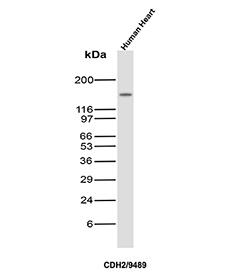 Cadherin 2 Antibody Tissue WB. Western blot analysis of N-Cadherin / CDH2 expression in human heart tissue lysate using Cadherin 2 antibody clone CDH2/9489. Lane 1: human heart lysate. A band is detected at approximately 120-135 kDa, consistent with the predicted molecular weight of N-Cadherin (CDH2), with the higher apparent migration reflecting known glycosylation of this membrane adhesion protein. The strong signal in heart tissue is expected given the established role of N-Cadherin in cardiomyocyte cell-cell adhesion and intercalated disc organization.