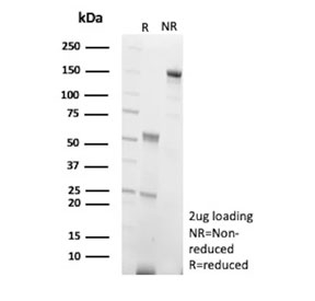 SDS-PAGE analysis of purified, BSA-free Cadherin 2 antibody (clone CDH2/9493) as confirmation of integrity and purity.