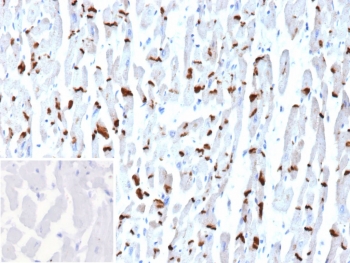 Cadherin 2 Antibody Human Heart Tissue IHC. Immunohistochemistry staining of FFPE human heart tissue with Cadherin 2 antibody (clone CDH2/9494). Inset: PBS used in place of primary Ab (secondary Ab negative control). HIER: boil tissue sections in pH 9 10mM Tris with 1mM EDTA for 20 min and allow to cool before testing.