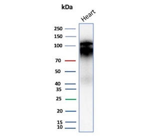 Cadherin 2 Antibody Human Heart Tissue WB. Western blot testing of human heart tissue lysate with Cadherin 2 antibody (clone CDH2/9494). Predicted molecular weight ~100 kDa (unmodified), 125-140 kDa (modified).