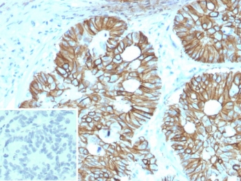 IHC staining of FFPE human colon tissue with LI-Cadherin antibody (clone CDH17/2614). Inset: PBS used in place of primary Ab (secondary Ab negative control). HIER: boil tissue sections in pH 9 10mM Tris with 1mM EDTA for 20 min and allow to cool before testing.