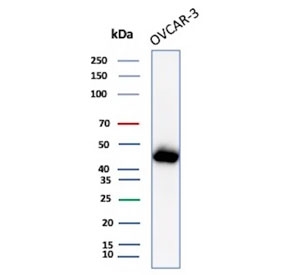 Western blot analysis of Mesothelin antibody in human OVCAR-3 cell lysate. A prominent band is observed at approximately 40-45 kDa, consistent with the cleaved membrane-associated form of Mesothelin, while the full-length precursor is predicted at approximately 69 kDa. Mesothelin is a glycoprotein and glycosylation can contribute to apparent molecular weight shifts on SDS-PAGE. Mouse monoclonal (Clone MSLN/3383) was used for detection.