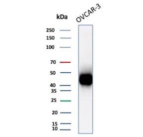 Western blot testing of human OVCAR-3 cell lysate with Mesothelin antibody (clone MSLN/8331R). Predicted molecular weight ~69 kDa (precursor), ~40 kDa (cleaved form). Glycosylation may make the protein run higher than expected.