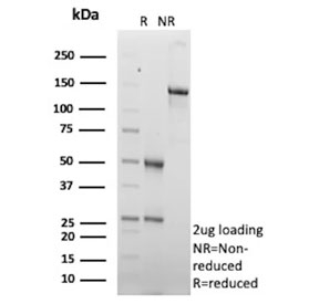 SDS-PAGE analysis of purified, BSA-free MOAT-B antibody (clone ABCC4/9178) as confirmation of integrity and purity.
