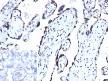 IHC staining of FFPE human placental tissue with recombinant CDKN1B antibody (clone PASE/4LJ). Inset: PBS used in place of primary Ab (secondary Ab negative control). HIER: boil tissue sections in pH 9 10mM Tris with 1mM EDTA for 20 min and allow to cool before testing.