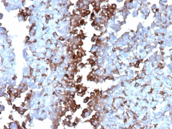 IHC staining of FFPE human adrenal gland tissue with Apolipoprotein J antibody (clone CLU/4737). Inset: PBS used in place of primary Ab (secondary Ab negative control). HIER: boil tissue sections in pH 9 10mM Tris with 1mM EDTA for 20 min and allow to cool before testing.