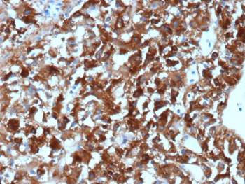 Clusterin Antibody for IHC Adrenal Gland Tissue. Immunohistochemistry analysis of FFPE human adrenal gland tissue using Clusterin antibody for IHC. The mouse monoclonal antibody clone CLU/4740 demonstrates strong cytoplasmic staining in adrenal cortical cells with prominent extracellular deposition, consistent with Clusterin / CLU expression as a secreted protein tissue marker. Signal outlines glandular architecture and extends into interstitial spaces, reflecting active secretion and accumulation of this chaperone protein within the tissue microenvironment, while background staining remains low. HIER: boil tissue sections in 10 mM Tris with 1 mM EDTA, pH 9, for 20 min followed by cooling prior to staining.