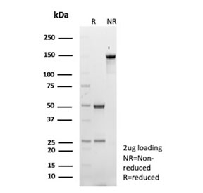 SDS-PAGE analysis of purified, BSA-free Clusterin antibody (clone CLU/12058) as confirmation of integrity and purity.