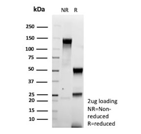 SDS-PAGE analysis of purified, BSA-free Colipase antibody (clone CLPS/9900) as confirmation of integrity and purity.