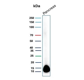 Western blot testing of human pancreas tissue lysate with CLPS antibody (clone CLPS/9898). Predicted molecular weight ~12 kDa.