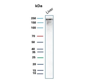 CPS1 Antibody Liver WB. Western blot analysis of Carbamoyl Phosphate Synthetase 1 / CPS1 in human liver tissue lysate using mouse monoclonal CPS1 antibody, clone CPS1/9859. A band is detected at approximately 165 kDa, consistent with the predicted molecular weight of CPS1, with signal occasionally observed at higher apparent molecular weights reflecting post-translational modification or protein complex association of this mitochondrial urea cycle enzyme.