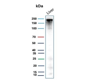 Carbamoyl phosphate synthetase 1 Antibody Liver Western blot. WB analysis of human liver lysate with Carbamoyl phosphate synthetase 1 antibody (clone CPS1/9867). Predicted molecular weight ~165 kDa but may be observed at higher molecular weights due to glycosylation.