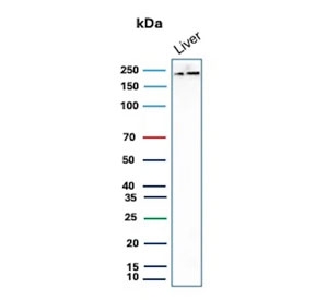 CPSase I Antibody Liver WB. Western blot analysis of Carbamoyl Phosphate Synthetase 1 / CPS1 in human liver tissue lysate using mouse monoclonal CPSase I antibody, clone CPS1/9869. A band is detected at approximately 165 kDa, consistent with the predicted molecular weight of CPS1, with additional signal observed at higher apparent molecular weights that may reflect post-translational modification or protein complex formation of this mitochondrial urea cycle enzyme.