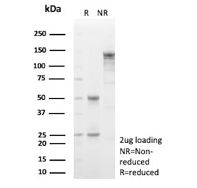 SDS-PAGE analysis of purified, BSA-free Decorin antibody (clone DCN/3521) as confirmation of integrity and purity.
