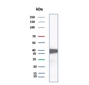 AKR1C1 Antibody A549 Cell WB. Western blot analysis of human A549 cell lysate using AKR1C1 Antibody (clone AKR1C1/9318) detects a band at approximately 37 kDa, consistent with the predicted molecular weight of AKR1C1 / Dihydrodiol dehydrogenase 1. The observed band supports detection of this cytosolic detoxification enzyme in lung-derived cells, aligning with its role in xenobiotic metabolism and cellular stress response pathways.
