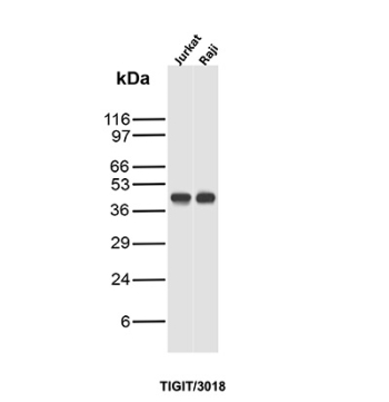 TIGIT Antibody Jurkat Raji WB. Western blot analysis of Jurkat and Raji cell lysates using TIGIT Antibody (clone TIGIT/3018) detects a band at the predicted molecular weight of approximately 26-30 kDa, consistent with TIGIT expression in lymphoid cell lines, with slightly higher apparent molecular weight likely reflecting glycosylated forms of this immune checkpoint receptor.