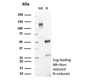 SDS-PAGE analysis of purified, BSA-free PLA2R1 antibody (clone PLA2R1/4891) as confirmation of integrity and purity.