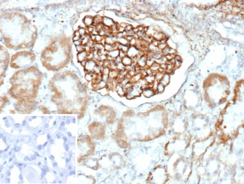 Immunohistochemistry analysis of PLA2R1/Phospholipase A2 receptor 1 antibody in human kidney tissue. Formalin-fixed, paraffin-embedded human kidney shows strong membranous HRP-DAB brown staining within glomerular podocytes, outlining the capillary loops, while surrounding tubular epithelial cells demonstrate comparatively weaker staining. The inset image represents the negative control in which PBS was used in place of the primary antibody, showing no specific brown chromogenic signal. Heat-induced epitope retrieval was performed by boiling tissue sections in pH 9 10mM Tris with 1mM EDTA for 20 minutes followed by cooling prior to immunostaining.