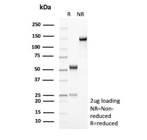 SDS-PAGE analysis of purified, BSA-free Phospholipase A2 receptor 1 antibody (clone PLA2R1/4894) as confirmation of integrity and purity.