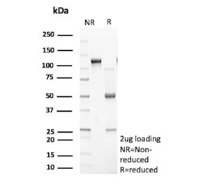 SDS-PAGE analysis of purified, BSA-free Secretory phospholipase A2 receptor antibody (clone PLA2R1/4896) as confirmation of integrity and purity.
