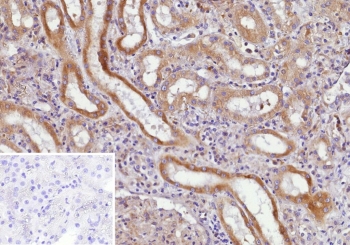 CD135 Antibody Kidney Immunohistochemistry. IHC staining of FFPE human kidney tissue with CD135 antibody (clone FLT3/9888). Inset: PBS used in place of primary Ab (secondary Ab negative control). HIER: boil tissue sections in pH 9 10mM Tris with 1mM EDTA for 20 min and allow to cool before testing.