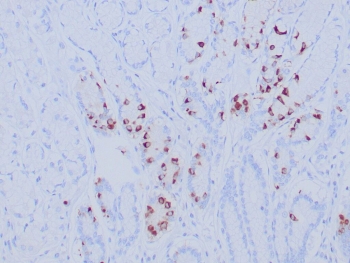 Recombinant Gastrin Antibody Gastric Antrum IHC. Immunohistochemistry staining of FFPE human gastric antrum tissue with recombinant Gastrin antibody (clone GAST/8646R). Inset: PBS used in place of primary Ab (secondary Ab negative control). HIER: boil tissue sections in pH 9 10mM Tris with 1mM EDTA for 20 min and allow to cool before testing.