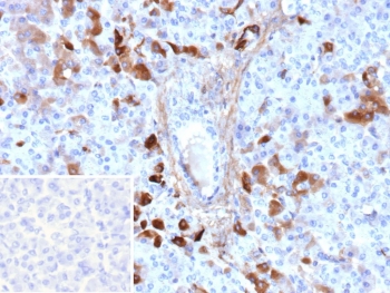 GC Antibody Pancreas IHC. Immunohistochemistry analysis of FFPE human pancreas tissue stained with GC Antibody / Serum Gc-Globulin Antibody clone VDBP/9980 demonstrates strong cytoplasmic HRP-DAB brown staining within pancreatic epithelial and endocrine-associated cellular populations, consistent with the role of Group-specific component / GC as a circulating plasma carrier protein involved in vitamin D transport and systemic metabolic homeostasis. The observed staining pattern aligns with the secretory biology of this serum Gc-globulin within endocrine-associated tissue compartments. The negative control inset using PBS in place of primary antibody demonstrates minimal background secondary antibody binding. HIER: boil tissue sections in pH 9 10mM Tris with 1mM EDTA for 20 min and allow to cool before testing.