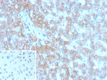 GC Antibody Liver IHC. Immunohistochemistry analysis of FFPE human liver tissue stained with GC Antibody / Serum Gc-Globulin Antibody clone VDBP/9980 demonstrates diffuse granular cytoplasmic HRP-DAB brown staining throughout hepatocyte-associated cellular populations, consistent with the role of Group-specific component / GC as a liver-derived plasma carrier protein involved in circulating vitamin D metabolite transport and systemic endocrine homeostasis. The widespread hepatic staining profile aligns with the established secretory biology of this abundant serum Gc-globulin. The negative control inset using PBS in place of primary antibody demonstrates minimal background secondary antibody binding. HIER: boil tissue sections in pH 9 10mM Tris with 1mM EDTA for 20 min and allow to cool before testing.
