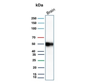 Western blot testing of human brain tissue with GFAP antibody (clone GFAP/9422). Predicted molecular weight ~50 kDa.