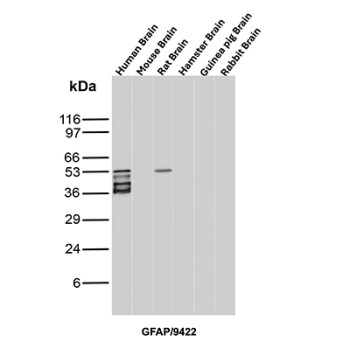 GFAP Antibody Brain Tissue WB. Western blot analysis of human brain, mouse brain, rat brain, hamster brain, guinea pig brain, and rabbit brain tissue lysates using GFAP Antibody clone GFAP/9422. Multiple closely migrating bands are detected between approximately 40-50 kDa in human brain lysate, with an additional band of similar molecular weight observed in rat brain tissue, consistent with Glial fibrillary acidic protein / GFAP, a major astrocytic intermediate filament protein involved in maintenance of neural cytoskeletal organization. The stacked banding pattern in the human brain sample likely reflects a combination of GFAP isoforms and partial proteolytic processing products commonly observed in neural tissue extracts.