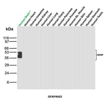 GFAP Antibody Multi-Tissue WB. Western blot analysis of human brain, heart, intestine, kidney, liver, lung, ovary, pancreas, prostate, skeletal muscle, skin, spleen, stomach, and testis tissue lysates using GFAP Antibody clone GFAP/9423. A distinct band is detected at approximately 50 kDa selectively in human brain lysate, consistent with the predicted molecular weight of Glial fibrillary acidic protein / GFAP, an astrocyte-associated intermediate filament protein enriched within central nervous system tissue. Multiple closely migrating lower molecular weight bands forming a stacked pattern beneath the primary signal likely represent GFAP isoforms and/or partial proteolytic processing products commonly observed in neural tissue extracts.