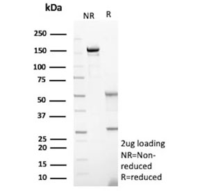 SDS-PAGE analysis of purified, BSA-free Glial fibrillary acidic protein antibody (clone GFAP/9425) as confirmation of integrity and purity.